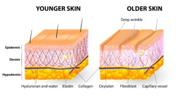 Verschil jonge en oudere huid