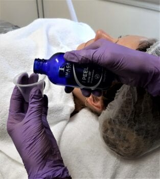 behandeling peeling image skincare i peel acne lift acne peeling de online kliniek den haag