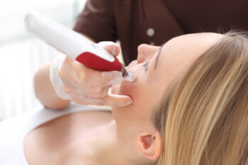 microneedling bij De Online Kliniek in Den Haag