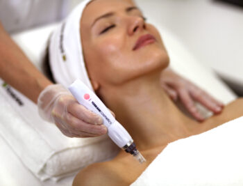 Microneedling